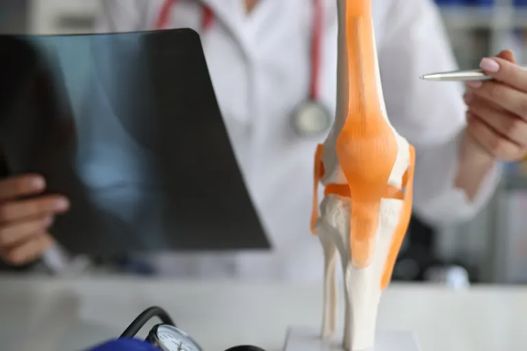 A doctor holds an X-ray and points at a knee joint model with highlighted ligaments.