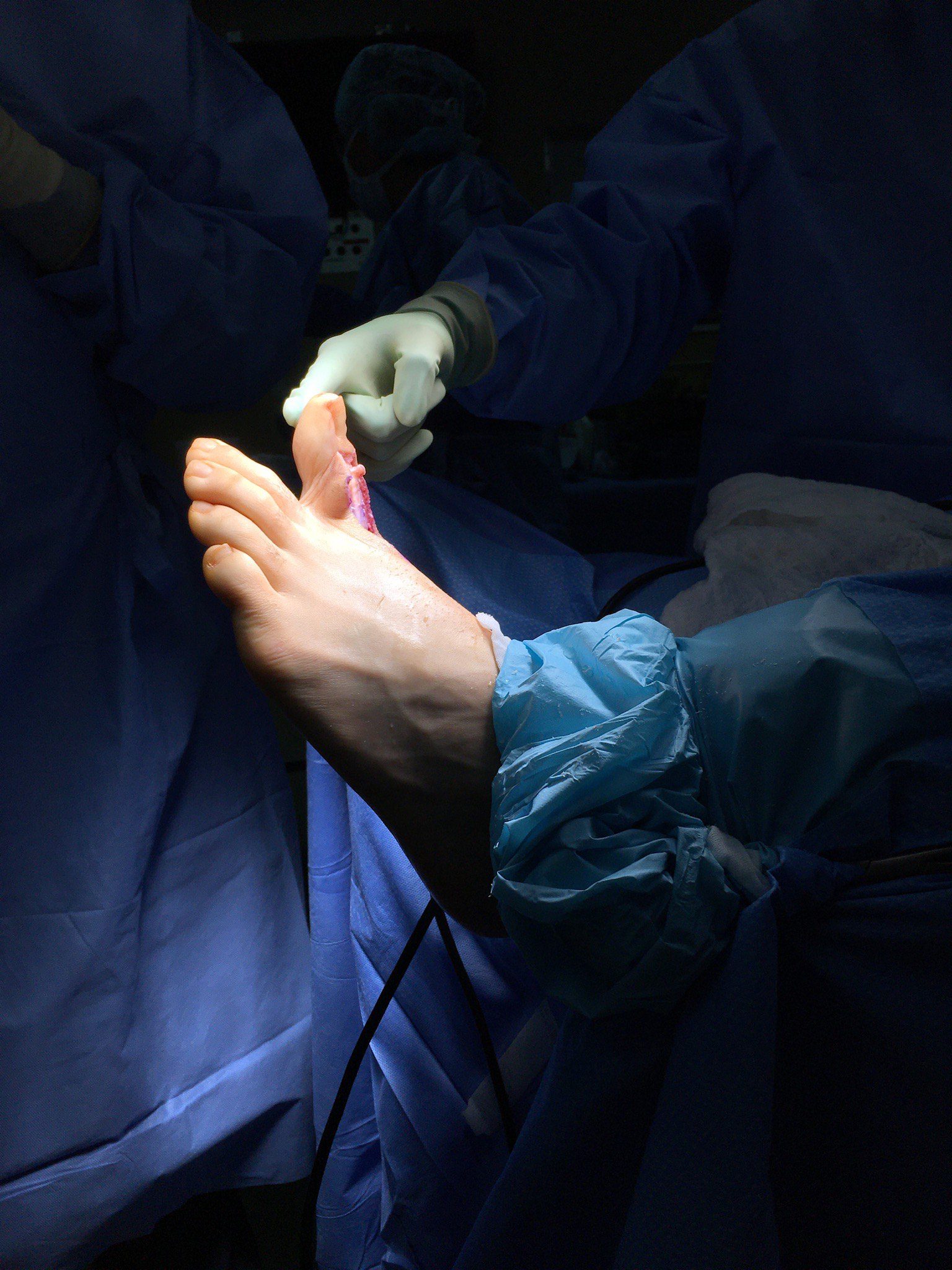 A surgeon wearing gloves performs a procedure on a patient’s foot in an operating room.
